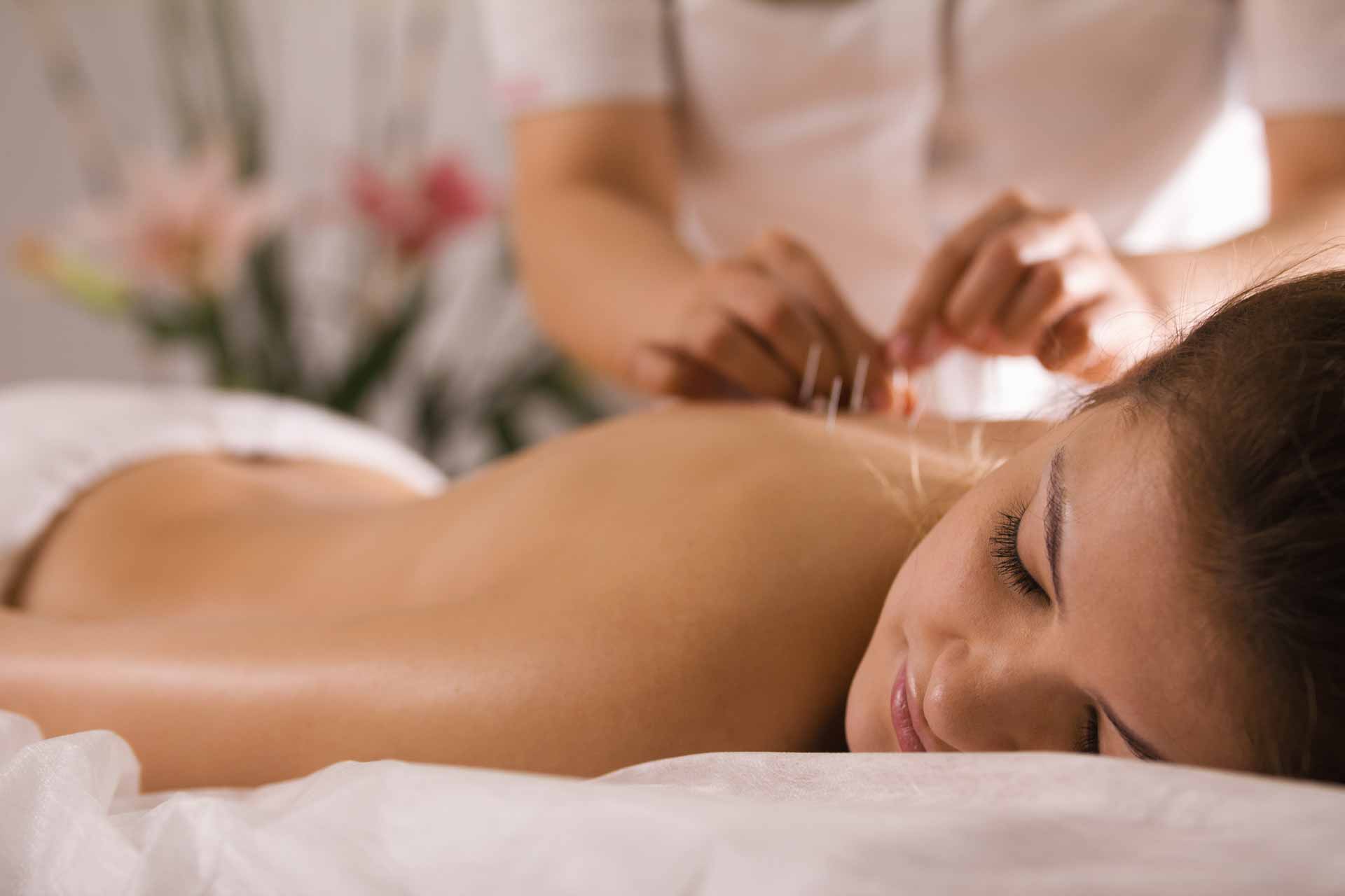 Woman serenely smiles while receiving acupuncture treatment