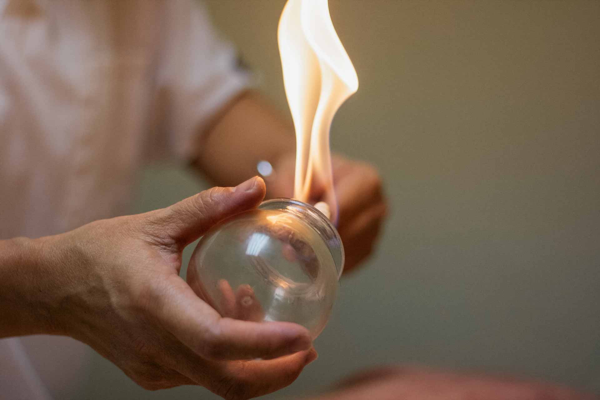 Heating up a glass cup for a fire cupping treatment